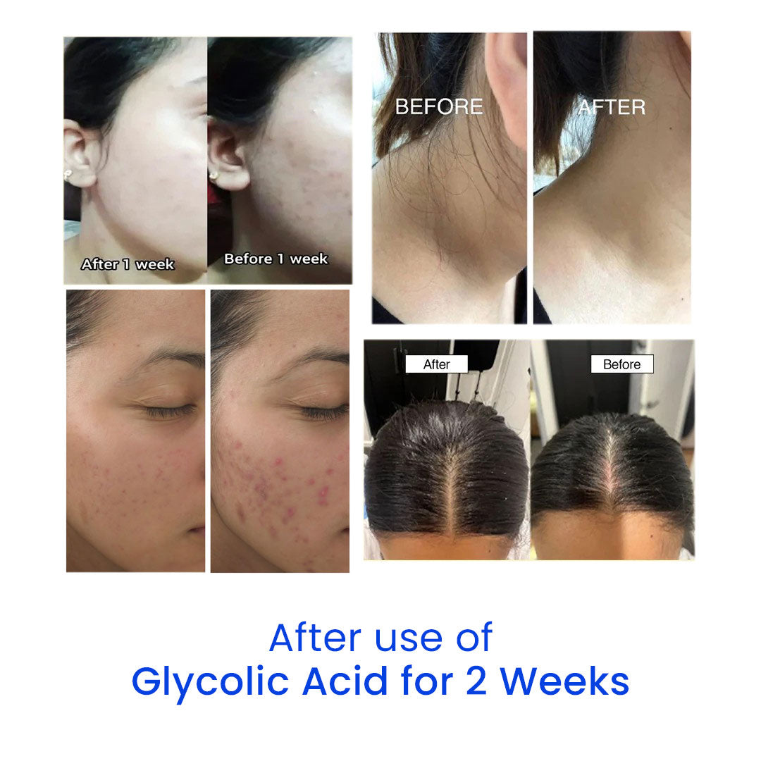 Glycolic Acid 7% Toning Solution