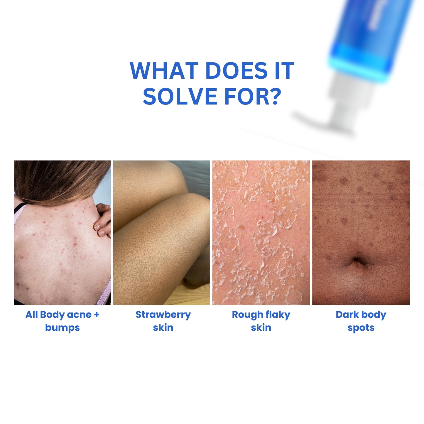 Salicylic Acid Body Wash